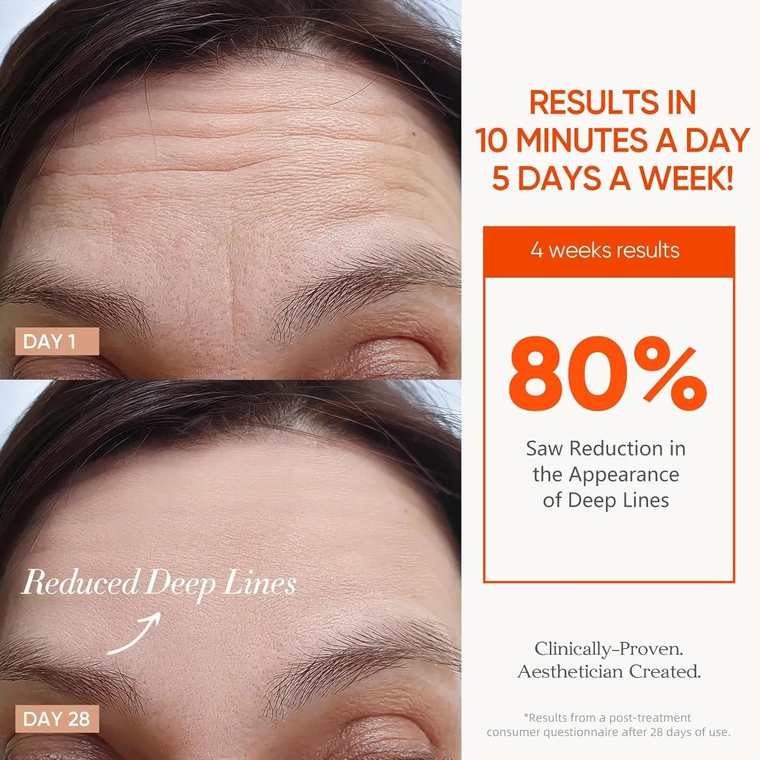 LumaGlow Red Light Therapy Mask