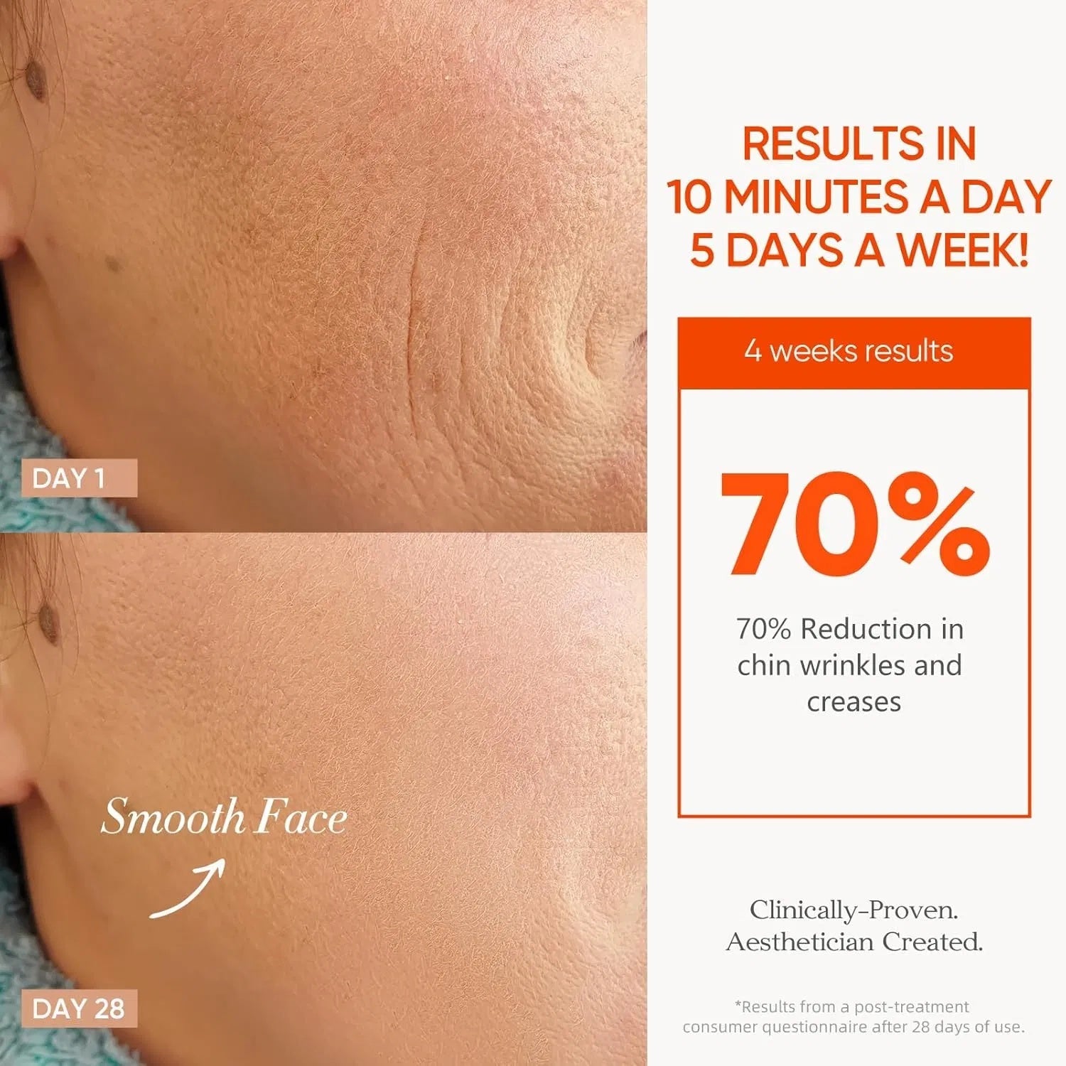 LumaGlow Red Light Therapy Mask
